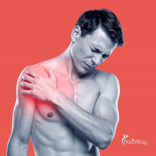 From Pain to Possibility: Thailand’s Shoulder Regeneration Stem Cell Treatment for Myanmar Patients